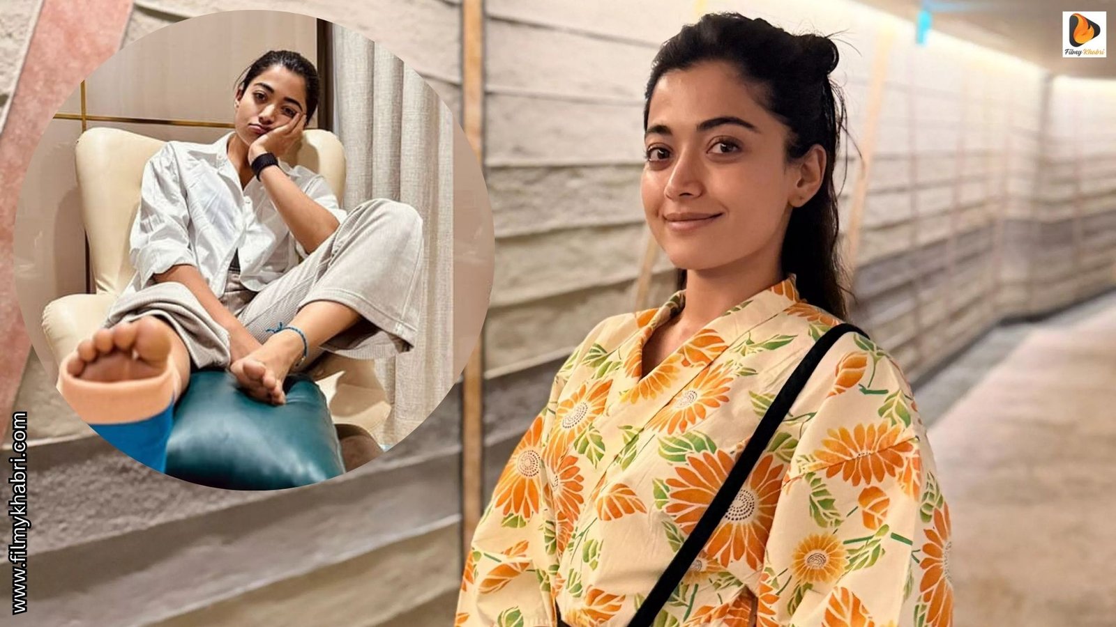 Rashmika Mandanna Suffers Injury During Stunt Shoot